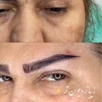 «کاشت ابرو طبیعی در بوشهر تیم پزشکی مجرب|خدمات آرایشگری و زیبایی|بوشهر, |دیوار