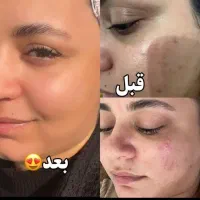 کرم وی ای پی تک و عمده