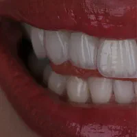 تخفیف و اقساط بلند مدت کلینیک دی|خدمات آرایشگری و زیبایی|آذرشهر, |دیوار