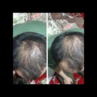 راهی نو برای تقویت و رشد مو