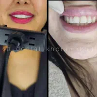 مرکز دندان اسپی دنتال