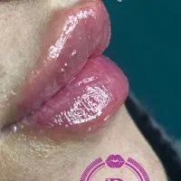 جشنواره تخفیف در کلینیک زیبایی تحت نظر پزشک