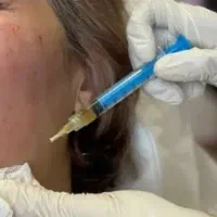 لیزر(خانم ها)۳۰۰لیزر(آقایان )۶۰۰و لیزر فوتونا۱۲۰۰|خدمات آرایشگری و زیبایی|نجفآباد, باغ ملی|دیوار