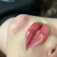 ژل لب، فیلر صورت، بوتاکس|خدمات آرایشگری و زیبایی|نجفآباد, امام خمینی|دیوار