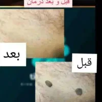 درمان|آرایشی، بهداشتی، درمانی|فیروزآباد (لرستان), |دیوار