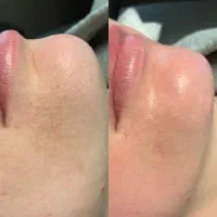 مدل رایگان خدمات فیشال و مراقبت پوست