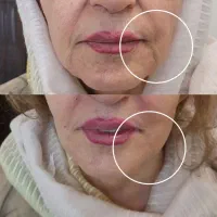 اسپارتینا زیکورپا لاغری بوتاکس فیلر مزوژل نخ لیفت|خدمات زیبایی و سلامت|تهران, هاشمی|دیوار