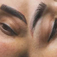 مدل میکروبلیدینگ رایگان