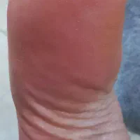 رفع ترک و تیرگی پا کفسابی پدیکور ۳۵۰ در یک جلسه|خدمات آرایشگری و زیبایی|بروجرد, |دیوار