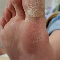 پدیکور و کفسابی خیس با بهترین مواد روز دنیا|خدمات آرایشگری و زیبایی|اصفهان, کارلادان|دیوار