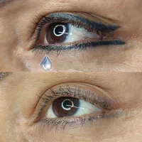 ریموو تتو خط چشم فقط با یک جلسه