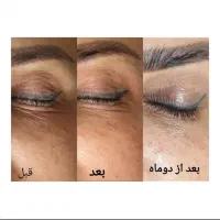 مدل فیشال و پاکسازی پوست صورت