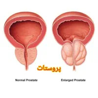 روغن تخم کدو ارگانیک، کمپرس سرد، کاژان