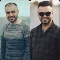 آفر باورنکردنی کاشت‌مو/کاشت‌ابرو تضمینی یک‌روزه|خدمات آرایشگری و زیبایی|کرج, عظیمیه|دیوار