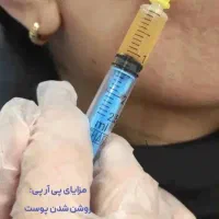 مزوتراپی،پی آر پی،پلاسما،آموزش پاکسازی، آف ویژه