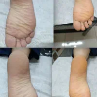 خدمات کفسابی پدیکور|خدمات آرایشگری و زیبایی|خرمآباد, |دیوار