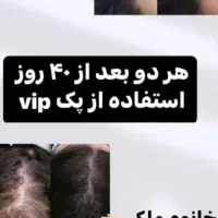 قطع کامل ریزش موباضمانت.تونیک گیاهی هیرفرند|آرایشی، بهداشتی، درمانی|اصفهان, شهرک ولیعصر|دیوار