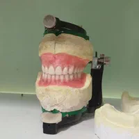 جشنواره تحویل یک روزه دندان مصنوعی (پروتز دندان)