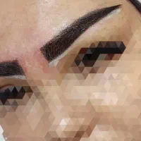 میکروکاشت ابرو بدون جراحی