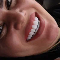 کامپوزیت دندان