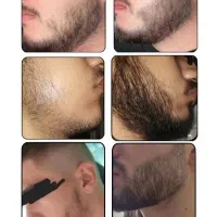 محلول رویش ریش و مو