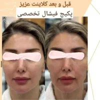 تخفیف  خدمات و آموزش فیشال تخصصی و پاکسازی