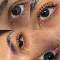 اگه ب زیبایی چهرت اهمیت میدی راه حلش پیش منه...