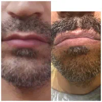 شیدینگ لب تخصصی آقایان بن مژه خط چشم ابرو|خدمات زیبایی و سلامت|تهران, میرداماد|دیوار
