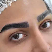 کاشت ابرو vip