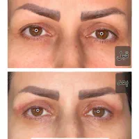 جشنواره تخفیف بلفاروپلاستی(جراحی پلک)|خدمات آرایشگری و زیبایی|شاهینشهر, فردوسی|دیوار