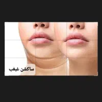 ساکشن غبغب وبوکال فت و چال گونه توسط پزشک در مطب|خدمات آرایشگری و زیبایی|مشهد, شهید فرامرز عباسی|دیوار