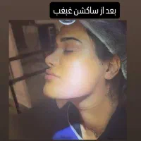 عمل بینی لیفت لیپو ابدو/دایرکت ابرو/رفع غبغب/کاشت|خدمات آرایشگری و زیبایی|کاشان, امیرکبیر|دیوار