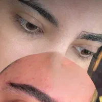 میکروبلیدینگ به سبک نانوبروز