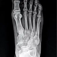 رادیولوژی در منزل آلارا|خدمات آرایشگری و زیبایی|مشهد, احمدآباد|دیوار