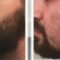 چهره‌ی الانتو فراموش میکنی