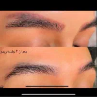 ریموو تتو