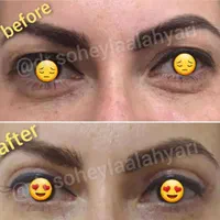 غبغب بوکال لیفت شقیقه سانترال چربی ژل بوتاکس|خدمات آرایشگری و زیبایی|شیراز, قدوسی غربی|دیوار