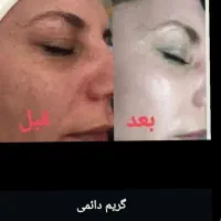 کرم پودر  و جوانساز|آرایشی، بهداشتی، درمانی|اهواز, یوسفی|دیوار