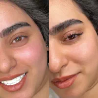 مدل اکستنشن رایگان