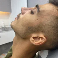 عمل بینی و لیفت صورت نقد و اقساط (بدون سود اضافه)|خدمات آرایشگری و زیبایی|تهران, الهیه|دیوار