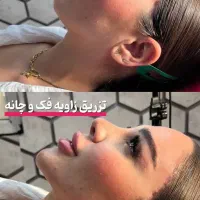 فقط امروز تزریق ژل با تخفیف عالی|خدمات آرایشگری و زیبایی|آبیک, |دیوار