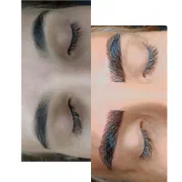 تخفیف فیبروزابروبمدت یک هفته