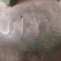 یک عدد کپسول