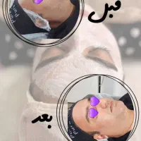 مدل فیشال، فقط هزینه مواد ثابت|خدمات آرایشگری و زیبایی|شیراز, فرهنگ شهر|دیوار