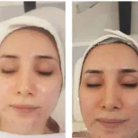 پاکسازی|خدمات آرایشگری و زیبایی|تبریز, |دیوار