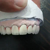 خدمات دندانسازی