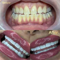دندانپزشکی و دندانسازی دیجیتال اقساطی