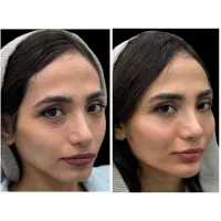 تخفیف ۳ روزه خدمات زیبایی