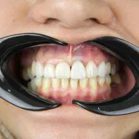 مرکز تخصصی ایمپلنت دیجیتال..|خدمات آرایشگری و زیبایی|تهران, زعفرانیه|دیوار