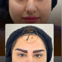 کاشت ابرو به روش futو میکرو کاشت|خدمات آرایشگری و زیبایی|اهواز, زیتون کارمندی|دیوار